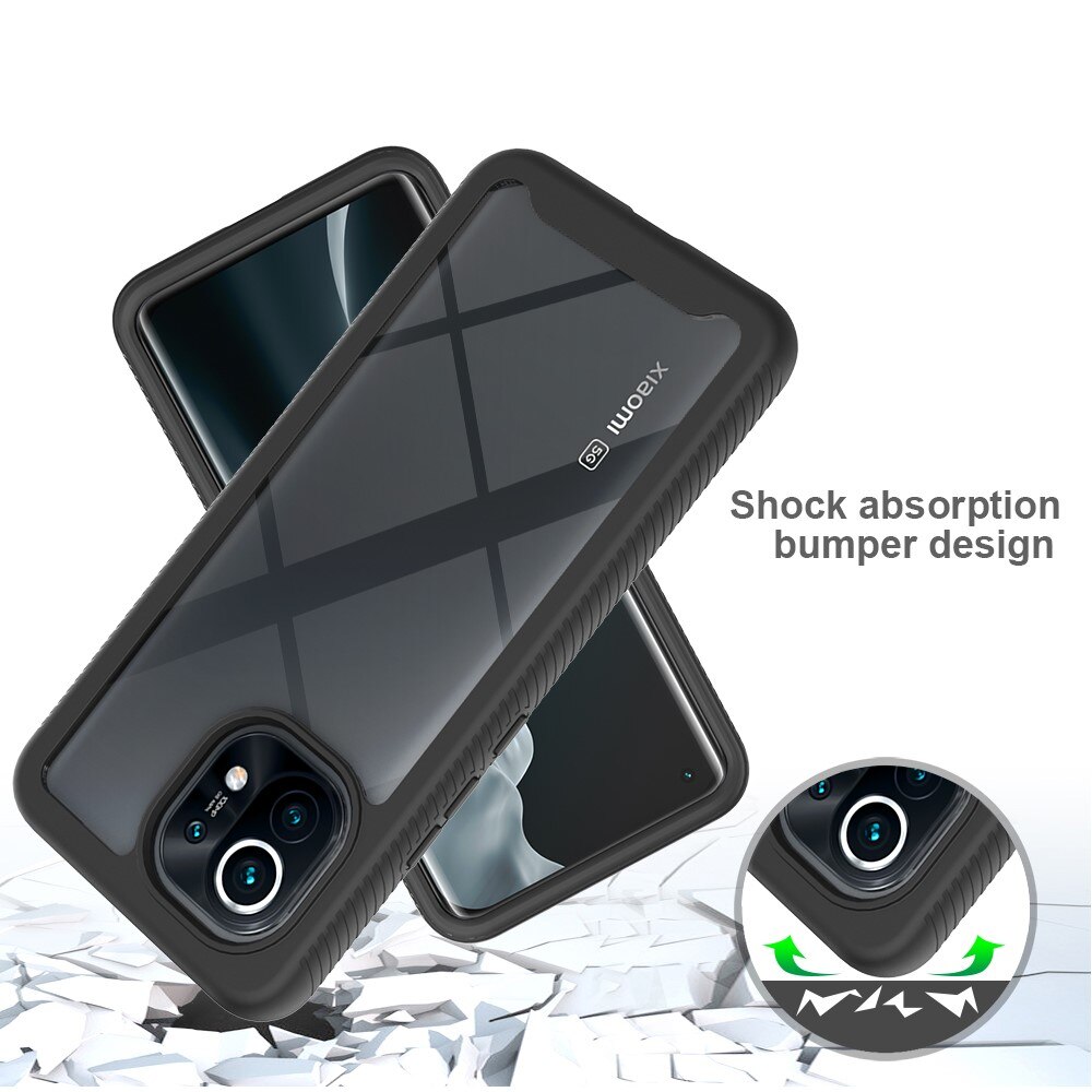 Full Cover Skal Xiaomi Mi 11 Svart